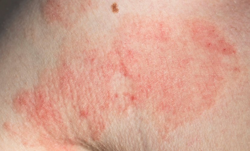 الأطباق المفضلة للعائلات