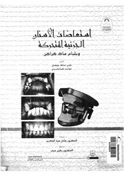 استعاضات الاسنان الجزئية المتحركة